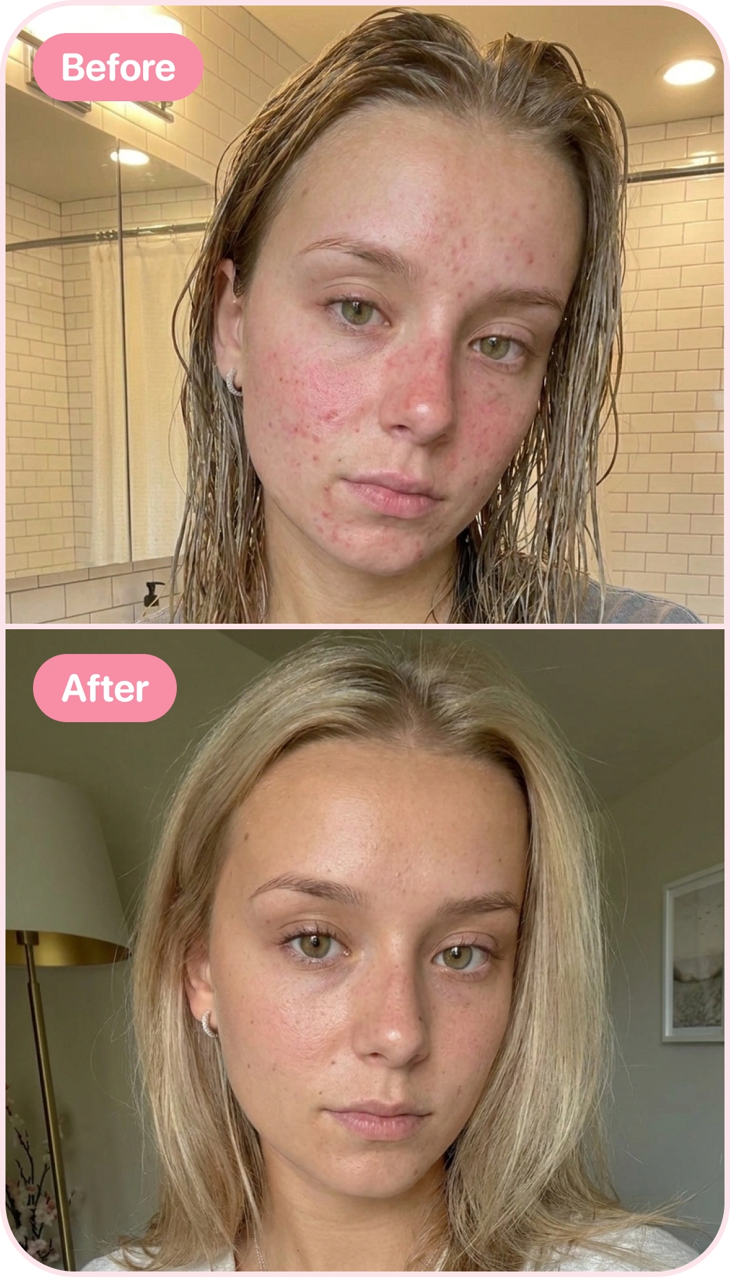 Before and after using glowapp